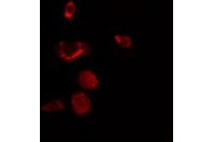 ABIN6272411 staining NIH-3T3 by IF/ICC. (RBM34 anticorps  (C-Term))