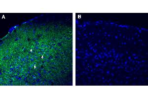 anti-Secreted Protein, Acidic, Cysteine-Rich (Osteonectin) (SPARC) (AA 179-194), (Secreted) antibody