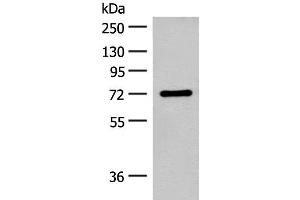 Western blot analysis of Rat brain tissue lysate using SLC6A11 Polyclonal Antibody at dilution of 1:500