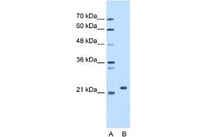 SDF2 antibody used at 1. (SDF2 anticorps  (N-Term))
