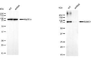 Western blotting analysis using small ubiquitin like modifier 1 antibody (ABIN7800382).