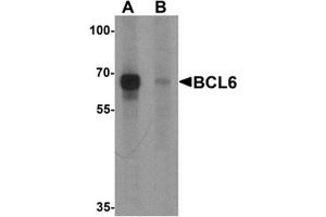 Western blot analysis of BCL6 in rat lung tissue lysate with Bcl6 Antibody  at 1 μg/ml in (A) the absence and (B) the presence of blocking peptide (BCL6 anticorps  (Middle Region))