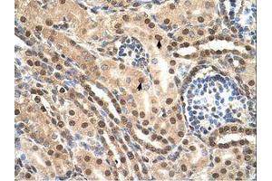 Image no. 2 for anti-Transcription Elongation Factor B (SIII), Polypeptide 2 (18kDa, Elongin B) (TCEB2) (C-Term) antibody (ABIN6737644)