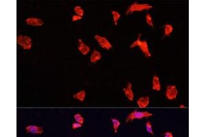 Immunofluorescence analysis of HeLa cells using ATP6V1B2 Polyclonal Antibody at dilution of 1:100. (ATP6V1B2 anticorps)