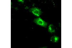 Image no. 3 for anti-Nucleotide Exchange Factor SIL1 (SIL1) antibody (ABIN1496810) (SIL1 anticorps)