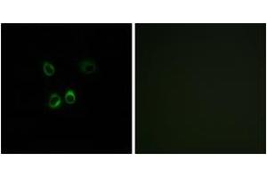 Immunofluorescence analysis of MCF7 cells, using RGR Antibody. (RGR anticorps  (AA 169-218))