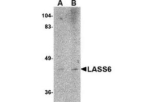 Western Blotting (WB) image for anti-Ceramide Synthase 6 (CERS6) (N-Term) antibody (ABIN1031437)