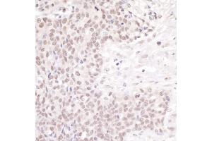 Immunohistochemistry (IHC) image for anti-Cleavage Stimulation Factor, 3' Pre-RNA, Subunit 1, 50kDa (CSTF1) (AA 75-125) antibody (ABIN7453410)