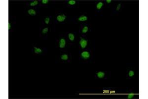 Immunofluorescence of monoclonal antibody to CSE1L on HeLa cell. (Exportin 2 anticorps  (AA 872-971))