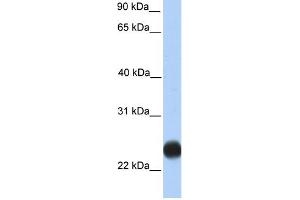 WB Suggested Anti-TMEM123 Antibody Titration:  0.