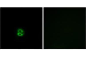 Immunofluorescence (IF) image for anti-Carbohydrate (N-Acetylglucosamine 6-O) Sulfotransferase 6 (CHST6) (AA 331-380) antibody (ABIN2890183) (CHST6 anticorps  (AA 331-380))