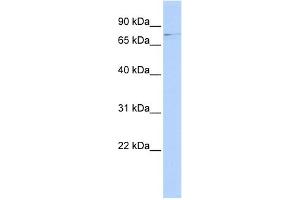 WB Suggested Anti-RRN3 Antibody Titration:  0. (RRN3 anticorps  (Middle Region))