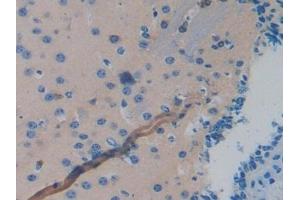 Detection of MAPT in Mouse Brain Tissue using Polyclonal Antibody to Tau Protein (MAPT) (tau anticorps  (AA 92-400))