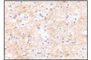 Immunohistochemical staining of human brain tissue using AP30751PU-N at 2. (DLGAP3 anticorps  (C-Term))