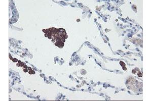 Image no. 2 for anti-Snail Family Zinc Finger 2 (SNAI2) antibody (ABIN1500985) (SLUG anticorps)