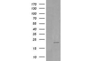 Image no. 4 for anti-HRas proto-oncogene, GTPase (HRAS) antibody (ABIN1498715) (HRAS anticorps)