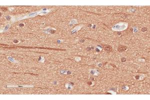 Immunohistochemical staining of human cerebral cortex tissue using anti-Beta Tubulin antibody.