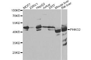 Western blot analysis of extracts of various cell lines, using PHKG2 antibody. (PHKG2 anticorps)