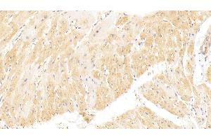 Detection of vWF in Rat Heart Tissue using Polyclonal Antibody to Von Willebrand Factor (vWF)