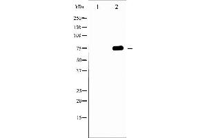 Western blot analysis of Tau phosphorylation expression in MDA-MB-435 whole cell lysates,The lane on the left is treated with the antigen-specific peptide. (MAPT anticorps  (pThr231))
