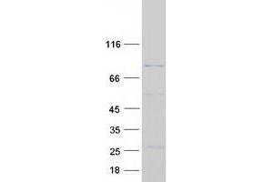 Validation with Western Blot