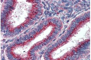 Human Uterus: Formalin-Fixed, Paraffin-Embedded (FFPE) (USO1 anticorps  (AA 1-962))