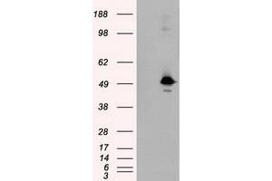 HEK293T cells were transfected with the pCMV6-ENTRY control (Left lane) or pCMV6-ENTRY KIAA1609 (Right lane) cDNA for 48 hrs and lysed. (KIAA1609 anticorps)
