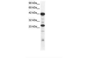 Image no. 2 for anti-SIX Homeobox 6 (SIX6) (AA 41-90) antibody (ABIN6735817) (SIX Homeobox 6 anticorps  (AA 41-90))