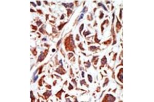 Image no. 2 for anti-BMI1 Polycomb Ring Finger Oncogene (BMI1) (C-Term) antibody (ABIN357748) (BMI1 anticorps  (C-Term))