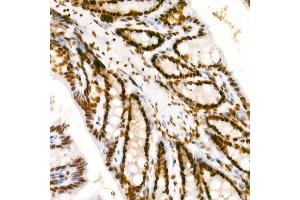 Immunohistochemistry of paraffin-embedded mouse colon using Phospho-POLR2A CTD-S2 Rabbit mAb  at dilution of 1:200 (40x lens). (POLR2A/RPB1 anticorps  (pSer2))