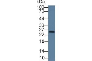 Detection of TK1 in Human Hela cell lysate using Monoclonal Antibody to Thymidine Kinase 1, Soluble (TK1) (TK1 anticorps  (AA 2-234))