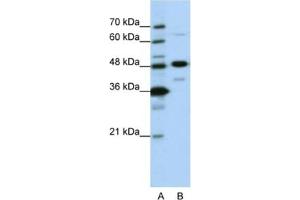 Western Blotting (WB) image for anti-Nucleolar Protein 4 (NOL4) antibody (ABIN2462155) (NOL4 anticorps)