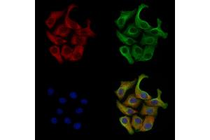 Phospho-GRK2 (Ser670) Antibody staining Hela cells(heat shock treatment) by IF/ICC. (GRK2 anticorps  (pSer670))