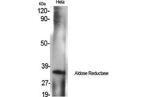 Western Blot (WB) analysis of specific cells using Aldose Reductase Polyclonal Antibody. (AKR1B1 anticorps  (C-Term))