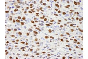 Immunohistochemistry (IHC) image for anti-Heterogeneous Nuclear Ribonucleoprotein H1 (H) (HNRNPH1) (C-Term) antibody (ABIN7448597) (HNRNPH1 anticorps  (C-Term))