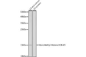 Western blot analysis of extracts of C6 cells, using MonoMethyl-Histone H2B-K5 antibody (ABIN7267735) at 1:500 dilution. (Histone H2B anticorps  (meLys5))