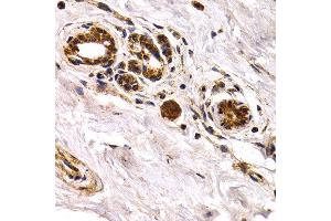 Immunohistochemistry of paraffin-embedded human normal breast using CHI3L1 antibody at dilution of 1:200 (400x lens). (CHI3L1 anticorps)