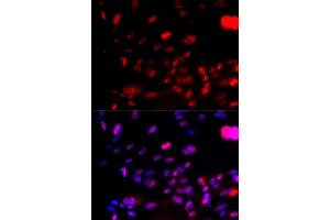Immunofluorescence analysis of U2OS cells using Phospho-CHEK1-S317 antibody (ABIN5969879). (CHEK1 anticorps  (pSer317))