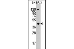 Western blot analysis of ACAT1 polyclonal antibody  in SK-BR-3 cell line lysates (35 ug/lane). (ACAT1 anticorps  (C-Term))