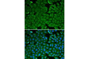 Immunofluorescence (IF) image for anti-serine Peptidase Inhibitor, Kazal Type 1 (SPINK1) (AA 24-79) antibody (ABIN6215027) (SPINK1 anticorps  (AA 24-79))