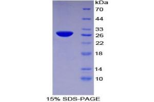 SDS-PAGE analysis of Human TFPI2 Protein. (TFPI2 Protéine)