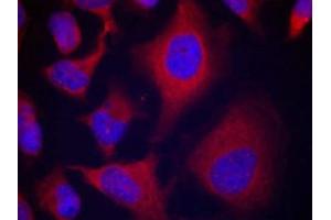 Immunofluorescence staining of methanol-fixed Hela cells using ADD1(Phospho-Ser726) Antibody.