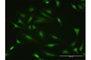 Immunofluorescence of purified MaxPab antibody to PTTG2 on HeLa cell. (PTTG2 anticorps  (AA 1-191))