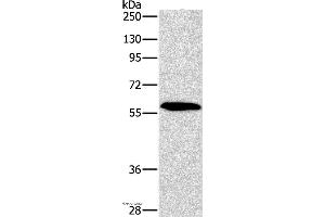 Western blot analysis of A172 cell, using PAK2 Polyclonal Antibody at dilution of 1:400 (PAK2 anticorps)