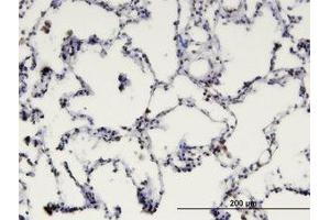 Image no. 1 for anti-Methyl-CpG Binding Domain Protein 1 (MBD1) (AA 415-509) antibody (ABIN599400) (MBD1 anticorps  (AA 415-509))