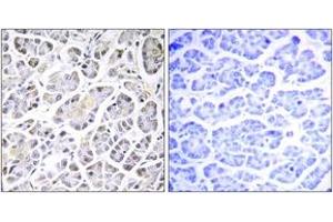 Immunohistochemistry analysis of paraffin-embedded human pancreas tissue, using ATP5G3 Antibody. (ATP5G3 anticorps  (AA 1-50))