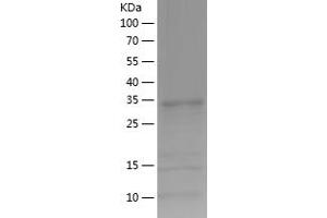 Western Blotting (WB) image for 2-Aminoethanethiol (Cysteamine) Dioxygenase (ADO) (AA 49-261) protein (His tag) (ABIN7121600)