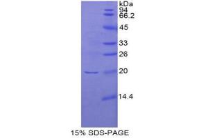 SDS-PAGE (SDS) image for Interferon, beta 1, Fibroblast (IFNB1) (AA 23-169) protein (His tag) (ABIN1880066)
