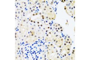 Immunohistochemistry of paraffin-embedded mouse kidney using SET/T antibody (ABIN6131353, ABIN6147631, ABIN6147634 and ABIN6221803) at dilution of 1:100 (40x lens). (SET/TAF-I anticorps  (AA 1-277))