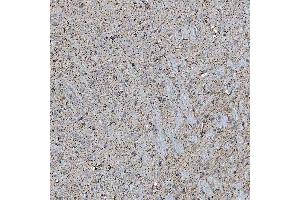 IHC analysis of SFXN5 using anti-SFXN5 antibody (ABIN7601388). (Sideroflexin 5 anticorps  (AA 34-340))